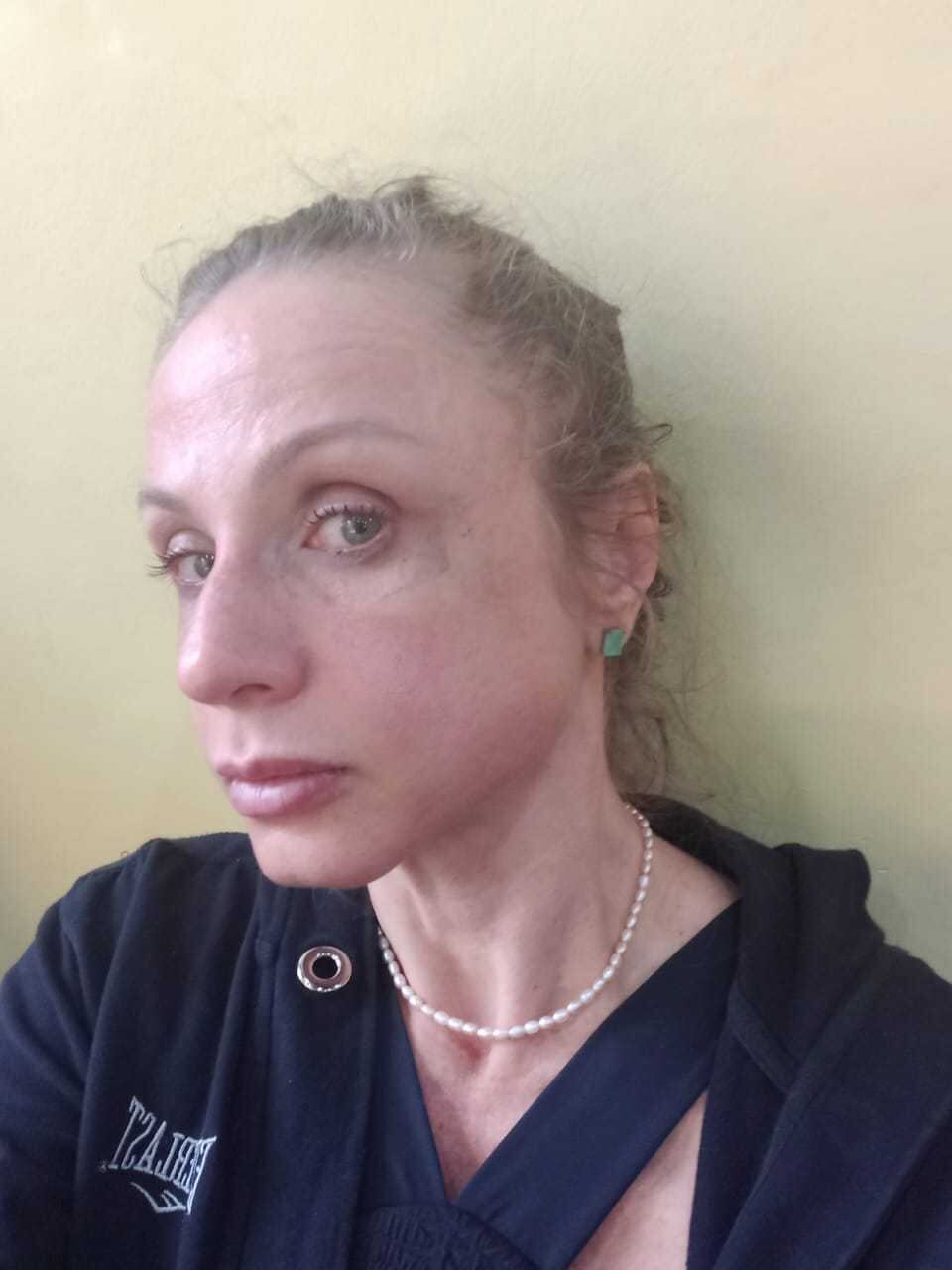 Verônica denunciou agressão