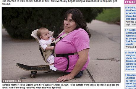 Rose amputou metade do corpo, mas conseguiu ter dois filhos