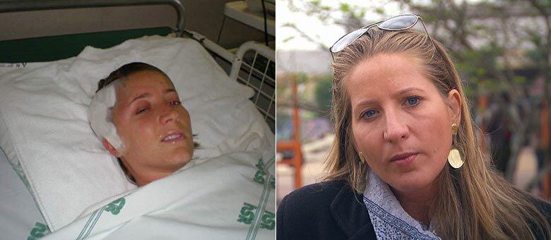 Fábia Taffarel conta sua história de superação no quadro Eu Sobrevivi