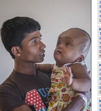 Vendo o progresso que Roona fez, o especialista decidiu que
realizará outra operação para diminuir ainda mais a cabeça da menina. Apesar da
confiança dos médicos, os pais da menina não estão tão confiantes com o novo
procedimento
À beira da morte, jovem com anorexia dá a volta por cima e admite: “Usava roupa infantil”