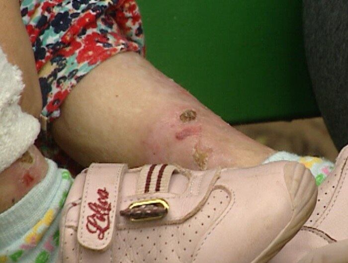 

Porém, por enquanto, a família não tem condições de arcar
com o custo de R$ 3 milhões
