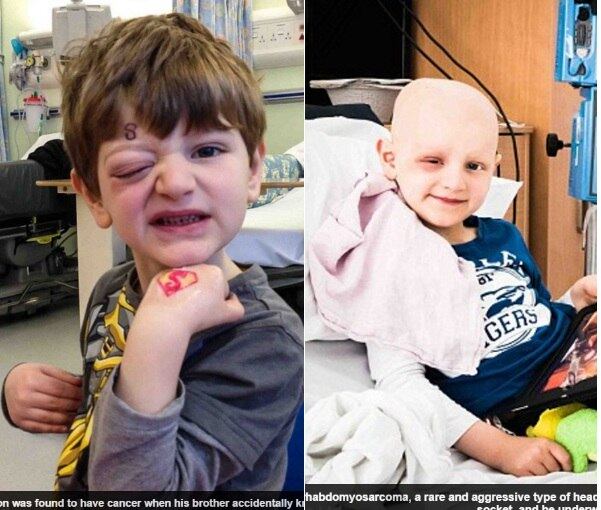 O pequeno William Richardson, de cinco anos, do Reino Unido,
foi diagnosticado com câncer após um brinquedo de plástico ter atingido seus
olhos