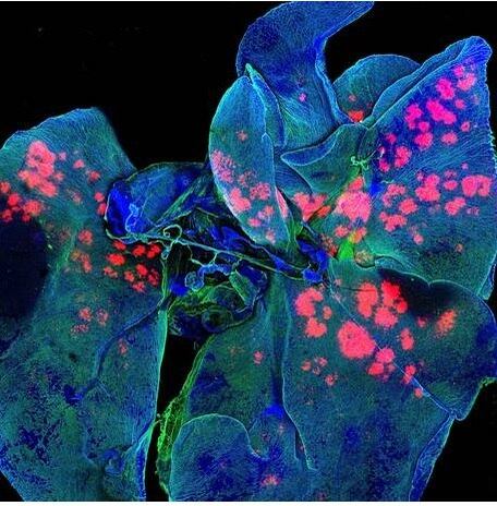Gregory
Szeto, Koch Institute, MIT, Massachussetts, nos Estados Unidos 


A imagem acima faz parte
de uma série de fotografias captadas quando os médicos injetaram partículas de
drogas no pulmão de ratos de laboratório. Os cientistas fizeram as imagens para
saber onde e quantas partículas do remédio chegam no local desejado