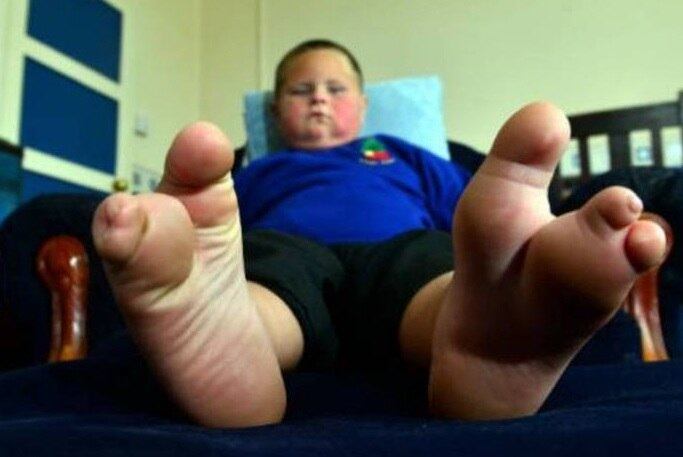 Jack Duncan-Hale nasceu com uma condição muito rara em que seus pés são “divididos” em dois. Por causa do problema, sua mãe se desespera por não ser capaz de encontrar nenhum calçado para seu filho. As informações são do site DailyMail