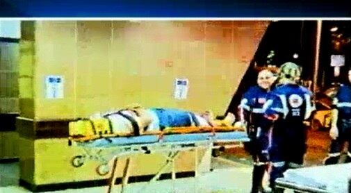 A idosa teve várias fraturas pelo corpo