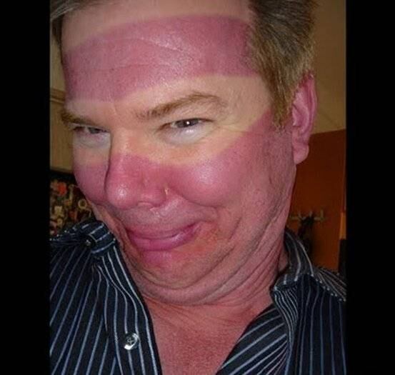 Perdeu a noção do tempo e gratinou sob a luz do sol? Sorria!