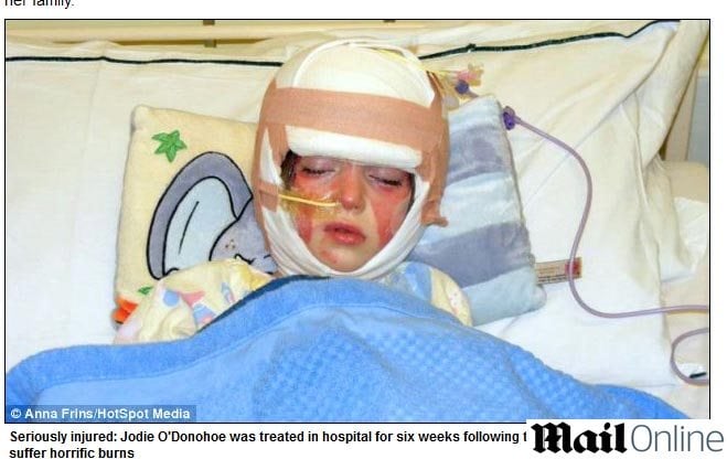 A menina teve cabelos,
sobrancelhas, cílios, lábios, orelhas e nariz escaldados, mas, ainda assim,
sobreviveu às queimaduras. Agora, os pais de Jodie adotaram medidas legais e
decidiram processar o fabricante do xampu