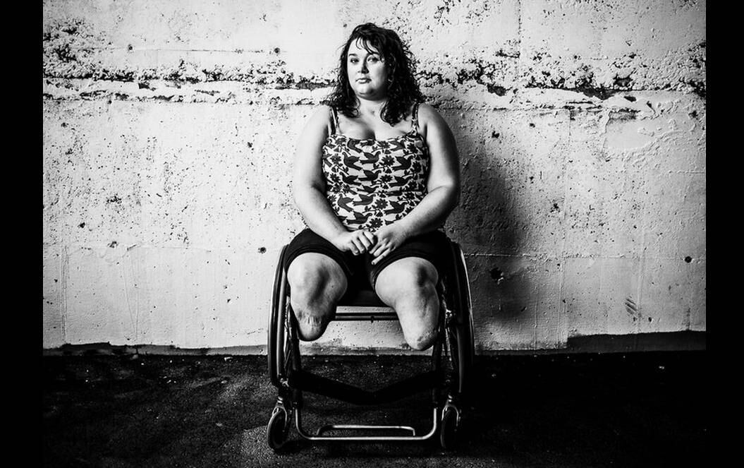 Na foto de Vogt, Jay
capturou a sensação de pular em uma piscina e sentir seu corpo descendo até o
fundo. Os braços de Vogt estão esticados, e seus olhos estão bem fechados.
Abaixo de sua sunga preta não há nada.





Vogt não sabe como
outras pessoas vão reagir ao ver sua foto, mas ele está feliz por ter feito o
retrato. “Me senti representado como uma pessoa. Sim, eu fiquei feliz com o
resultado”.

 

Marissa Strock (acima) tinha
só 20 anos quando seu veículo foi atingido por uma bomba caseira
