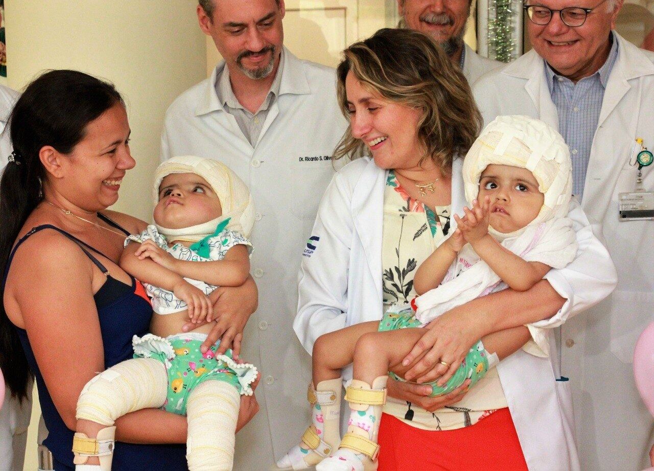 siamesas, separadas, cirurgia, ysabelle, ysadora