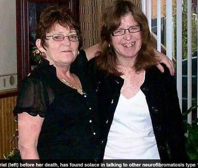 Noreen
revela receber apoio de amigos e de outros portadores da doença que ela
conheceu pela internet