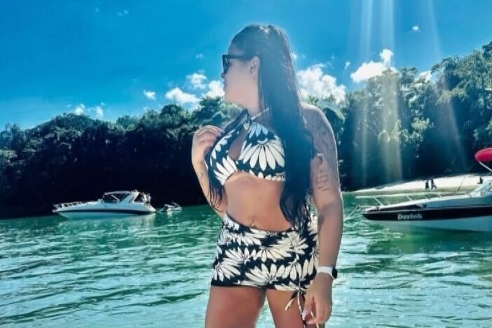 Silvia Olly morreu dois dias após lipoaspiração