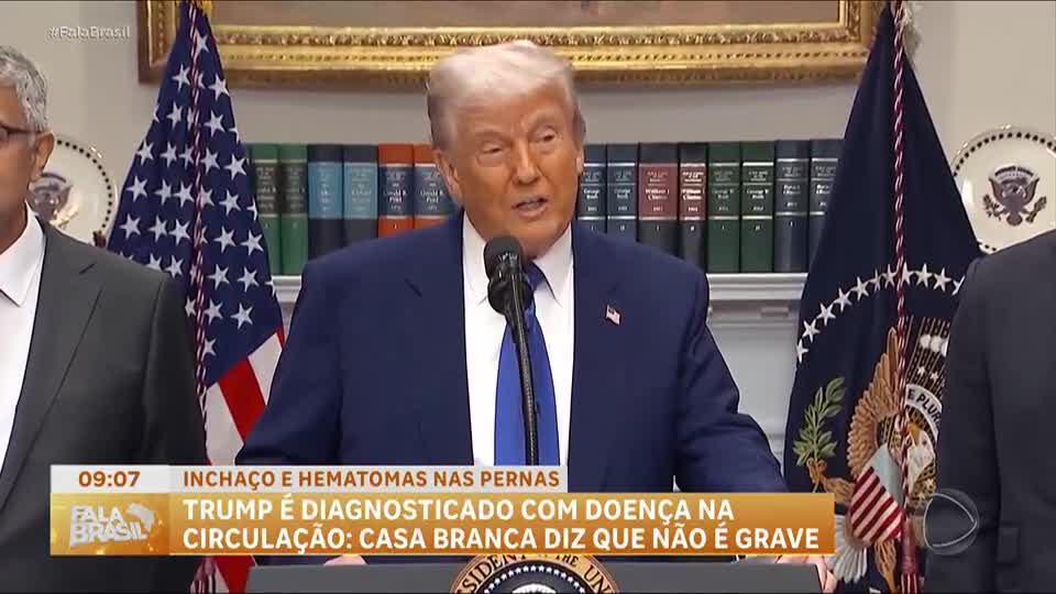 Donald Trump é diagnosticado com insuficiência venosa crônica