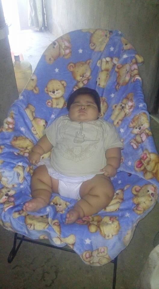 Andréa diz que alguns fatores são determinantes para o
estabelecimento da obesidade na infância: desmame precoce e introdução de
alimentos complementares não apropriados como: doces, bolachas, bebidas
adocicadas.

— Inclusive os sucos de frutas não são recomendados para crianças
menores de dois anos de idade pela Sociedade Brasileira de Pediatria, pela quantidade de
frutose [açúcar das frutas].  Uso de fórmulas lácteas incorretamente
preparadas e maus hábitos alimentares da própria família.

Os 1.000 primeiros dias do bebê são essenciais
para a formação dos hábitos alimentares da criança, pois serão mantidos na vida adulta, ressalta a pediatra 