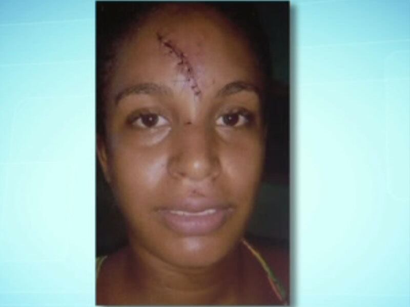 Uma vendedora ambulante diz ter sido espancada e ameaçada de morte pelo próprio namorado em Salvador. A agressão aconteceu depois que a vítima descobriu que o homem era casado e tinha dois filhos. Mariana Sacramento Santos, de 25 anos, levou 16 pontos na testa e outros dois nos lábios. Mariana e Afonso namoraram por seis anos e ela garante que ele, mesmo ciumento, nunca foi violento antes. O suspeito negou as acusações e disse que a empurrou e a mulher teria caído com o rosto no chão