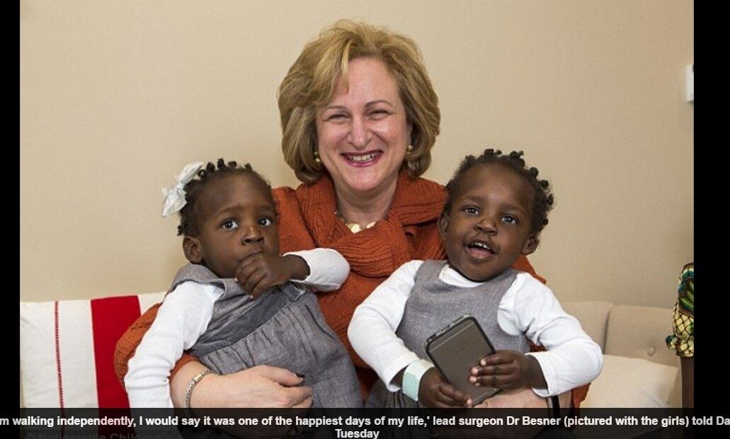 Com um ano de cirurgia, elas já conseguiam ficar em pé
sozinhas, como verificou Gail na primeira consulta após o procedimento 
