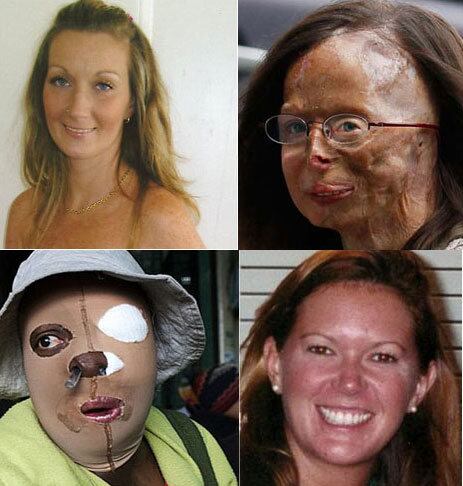 A violência contra a mulher tem crescido no mundo, chamando a atenção da comunidade internacional para os ataques cada vez mais agressivos contra mulheres de todas as idades. Países como Paquistão, Afeganistão, Colômbia e o próprio Brasil já foram palcos para ataques chocantes. Conheça alguns dos ataques contra mulheres mais violentos ao redor do mundo