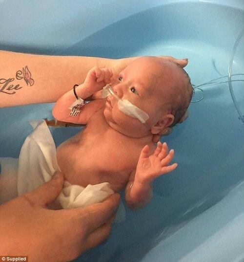 Uma bebê que nasceu com seis meses pesando apenas 625 gramas está lutando pela vida em Queensland. A mãe, Lisa Connor-Melville, de 24 anos, tomou um susto quando sua bolsa estourou inesperadamente em 23 de agosto. As informações são do portal de notícias britânico DailyMail