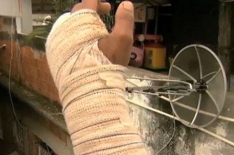 Polícia teria usado gás de pimenta em moradores