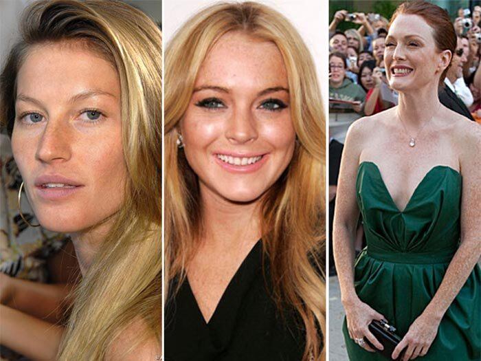 As sardas são marca registrada de muitas famosas, entre elas
Lindsay Lohan, Gisele Bündchen, Julianne Moore etc