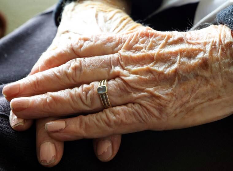 Alzheimer acomete mais de 35 milhões de pessoas em todo o mundo, sendo 1,2 milhão só no Brasil