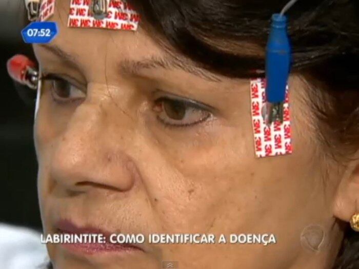 A labirintite é um termo popular usado geralmente referindo-se aos
distúrbios do labirinto. Às
vezes tonturas e vertigens podem significar o primeiro sinal de alguma
doença importante

+ Veja reportagem completa com otorrinolaringologista