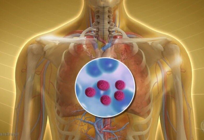 Esse novo método desenvolvido pelos pesquisadores americanos promete tratar a causa da doença
