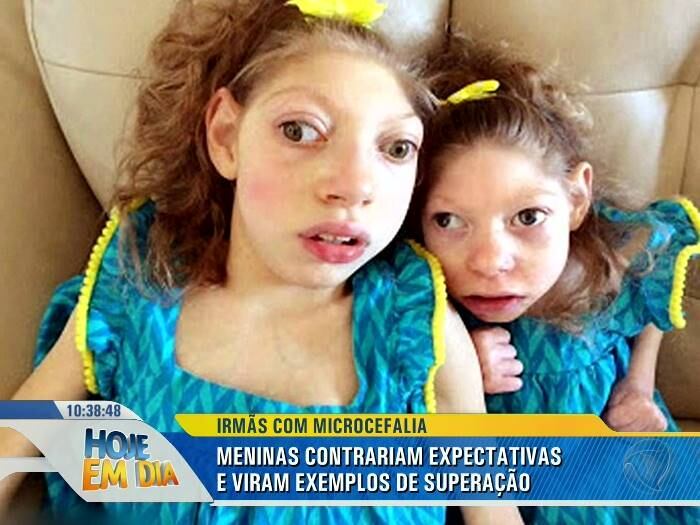 Muito
antes da microcefalia ser associada ao zika vírus, as duas nasceram com a
síndrome na qual o tamanho do cérebro é menor que o normal e o desenvolvimento
da criança é seriamente afetado
+ Médicos fazem cesárea de emergência e não encontram bebê
+ Acesse R7 Play e assista às íntegras do Hoje em Dia! Clique e experimente de graça!