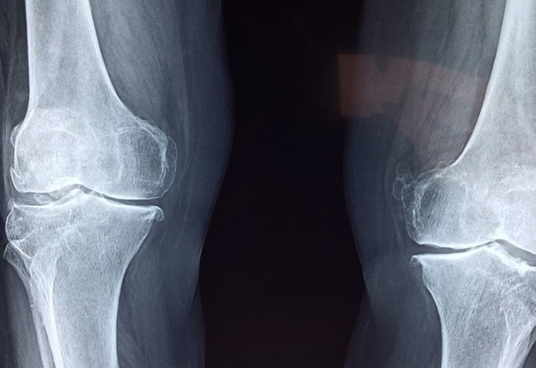 "Qualquer situação de urgência e emergência, seja uma apendicite ou um acidente de trânsito, terá que ter todo o atendimento", esclarece o advogado Paulo Henrique Minhoto.