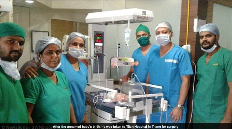 Em uma operação bem-sucedida, os médicos
removeram a massa de sete centímetros. O bebê e a mãe, de 19 anos, de Mumbra, na Índia, estão bem e saudáveis