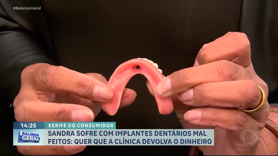 Xerife do Consumidor: Mulher tem complicações com prótese dentária e clínica não se responsabiliza