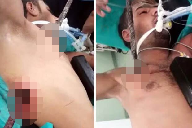 Espera-se que Ozcoban seja liberado para continuar sua recuperação em casa nos próximos dias


(Com informações do Daily Star)