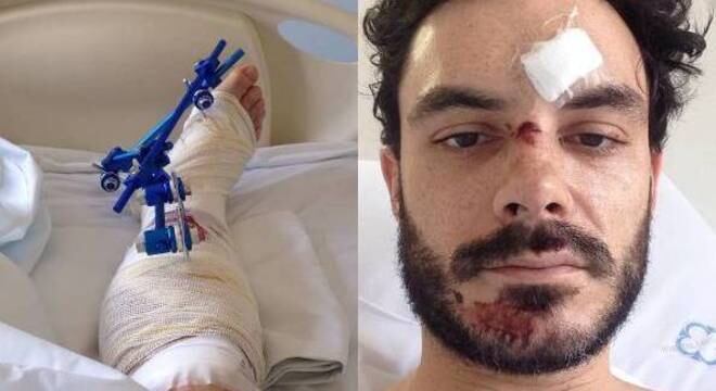 Kiko mostrou os ferimentos que teve após acidente de bicicleta