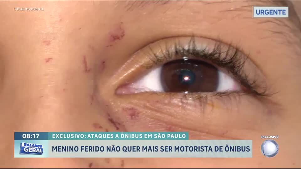 Menino desiste de ser motorista após ficar ferido em ataque a ônibus em São Paulo