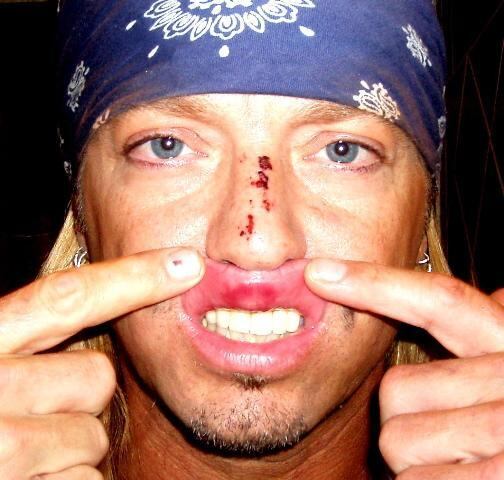 Era para ser uma noite de celebração, mas a apresentação do Poison no Tony Awards em 2009 acabou em tragédia: o vocalista da banda, Brett Michaels, foi atingido pelos equipamentos de palco que caíram. Ele teve uma hemorragia cerebral meses depois, que acredita ter sido consequência do acidente