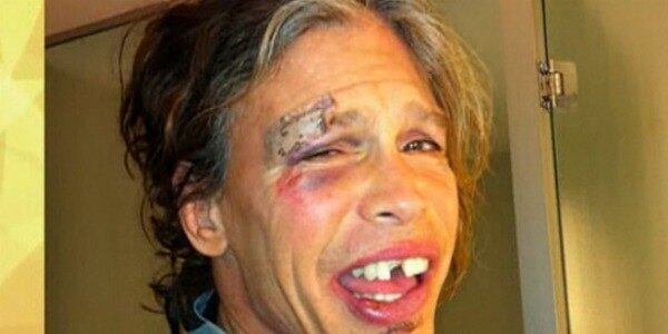 Em 2011, Steven Tyler, vocalista do Aerosmith, teve a infelicidade de quebrar um dente e ter o rosto completamente lesionado ao escorregar no banheiro de um hotel no Paraguai