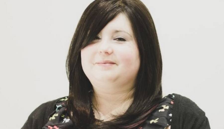 A terapia de reposição de cabelo, chamada intralace, dura dois anos