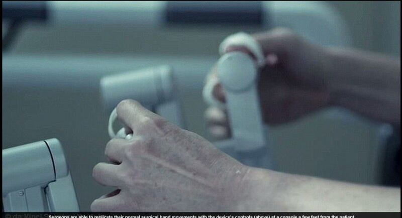 A ideia de operar pacientes com pequenas aberturas
busca diminuir os casos de pacientes com grandes cicatrizes