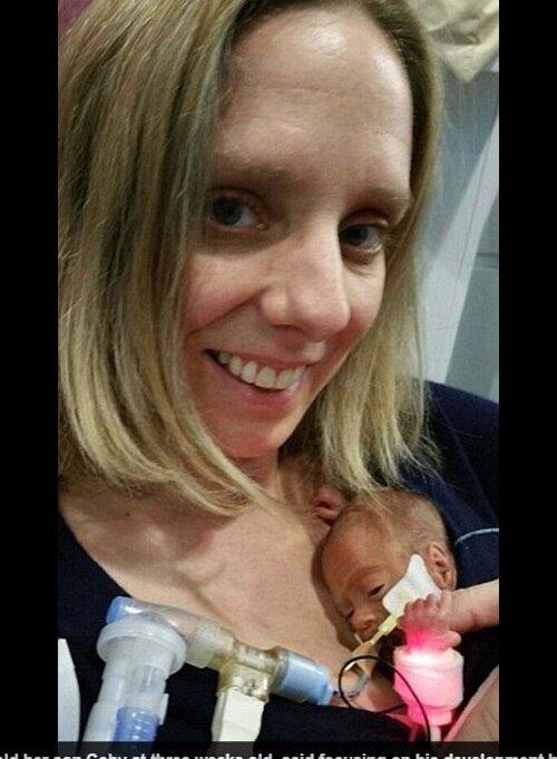 Quando começou a sentir dores com somente 22 semanas de
gravidez, Alison Barker ficou com muito medo. Os médicos disseram para ela
levantar da cama somente se fosse extremamente necessário, para conseguir “atrasar”
o parto o máximo possível