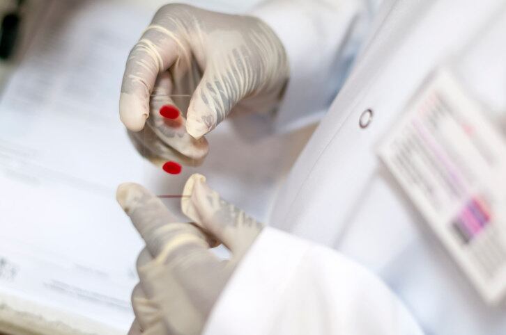 Todas as UBSs de Suzano estão preparadas para atender a população e realizar os teste rápidos de HIV, sífilis e hepatites