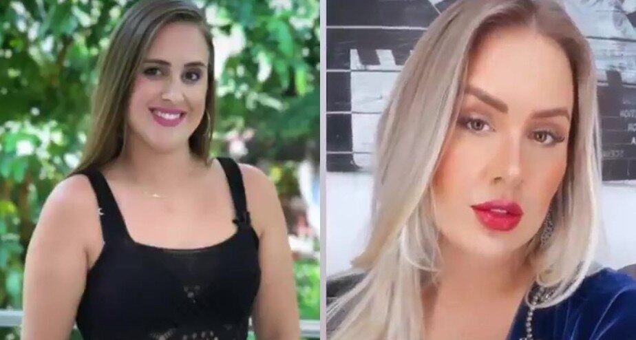 Patrícia Leitte antes e depois de fazer intervenções estéticas