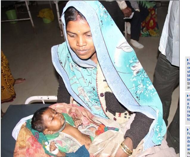 Desesperados, os pais de Shivani levaram a menina para o hospital
do governo distrital, onde, depois de tratá-la para a pneumonia, foi descoberto
um problema grave no coração, que também foi tratado para que não trouxesse
ainda mais problemas no futuro. 


De acordo com o médico que tratou a menina, Gobind Singh, o
ritual realizado em Shivani é comum em tribos na índia. Acredita-se que o
procedimento cure malária, icterícia, convulsões o outras doenças comuns.



― Não podemos culpar os pais por realizarem o
procedimento. Eles são analfabetos e não sabem nada de medicina. Quando vemos
casos como esse, tentamos educar os pais e explicar a importância de consultar
médicos quando acontecem problemas de saúde