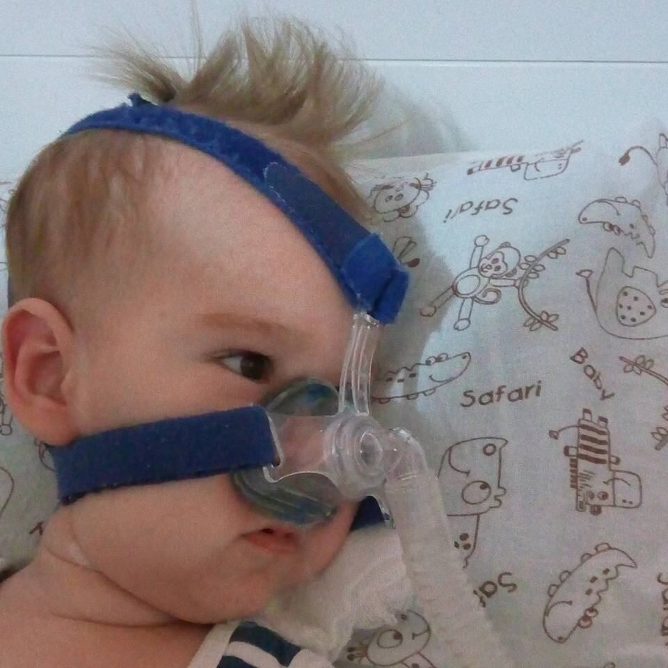 A
condição também faz com que o pequeno não consiga sentar, andar e nem comer por
conta própria. Por conta disso, seus pais tiveram que abandonar seus empregos e
se dedicar totalmente a cuidar da criança