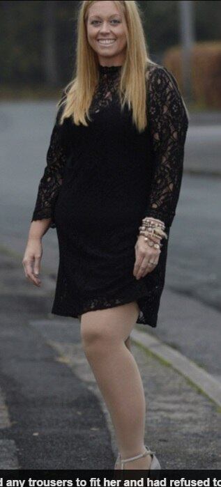 Segundo Faye, nada que ela fazia era suficiente para
diminuir o tamanho das pernas.


— Não importa o que eu fizesse, elas ficavam
cada vez mais gordos