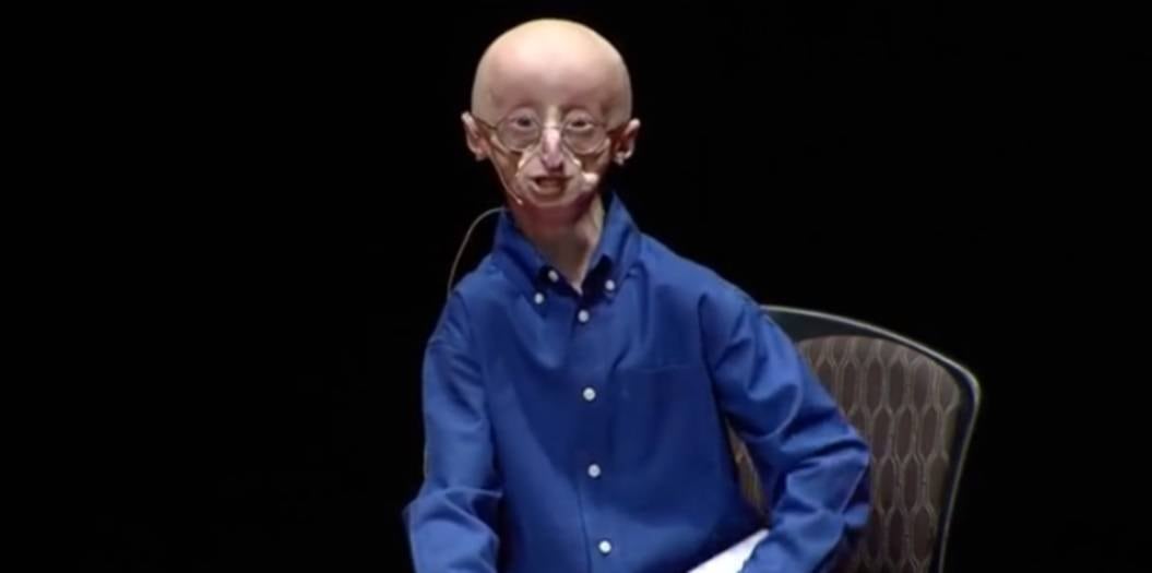 

Berns dedicou parte de sua vida dando palestras
motivacionais para falar sobre a vida. Apesar de sua doença rara, ele sempre
dizia que viveu uma "vida muito feliz”. Em uma de suas palestras
motivacionais, ele afirmava que não queria que as pessoas se sentissem mal por
ele.



— Embora existam muitos obstáculos na minha vida, não quero
que as pessoas se sintam mal por mim. Não penso nestes obstáculos o tempo todo.
Sou capaz de superar a maioria deles 