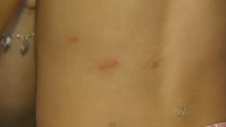 Depois do choque, a criança chegou a passar a noite no hospital. O
menino ainda está traumatizado com o que aconteceu. Veja o vídeo aqui


— Eu estou com medo de encostar nas coisas