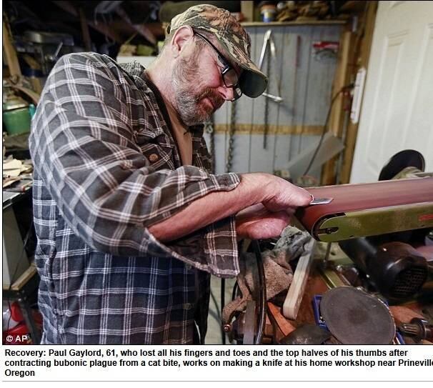 Por
causa da peste, o homem teve parte dos dedos das mãos amputadas. Soldador aposentado, agora ele passa a maior parte de seu tempo livre
fazendo facas na garagem da sua casa