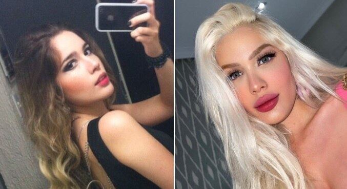 Antes e depois de Karoline Lima surpreendeu na web