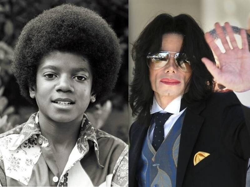 Até o resultado de sua autópsia, muitos desconfiavam que alteração do tom da pele de Michael Jackson não estivesse relacionado com o vitiligo. O Rei do Pop foi bastante criticado pela mudança e chegou a se cogitar que ele fazia tratamentos para parecer mais branco