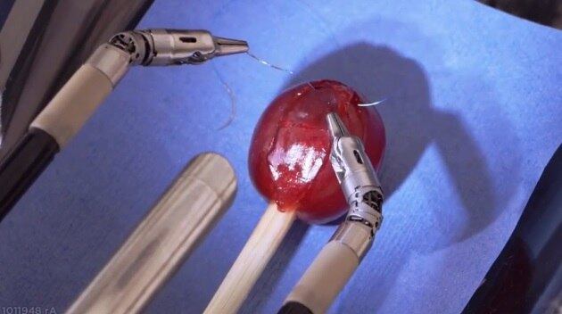 O custo do aparelho é de aproximadamente R$ 6
milhões