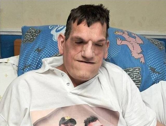 O jovem Robert Smith, 24 anos, morreu em casa após sofrer um ataque cardíaco fulminante. Com 2,13 m de altura, ele nunca parou de crescer por causa de uma doença rara